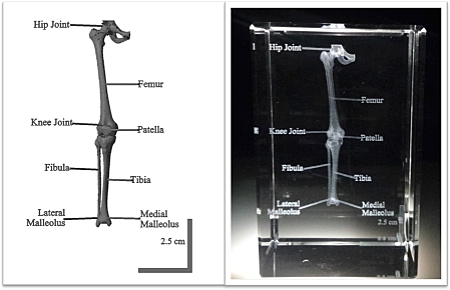 3d خرۇستال رەسىمدىكى كلىنىكىلىق ct سانلىق مەلۇماتلىرى